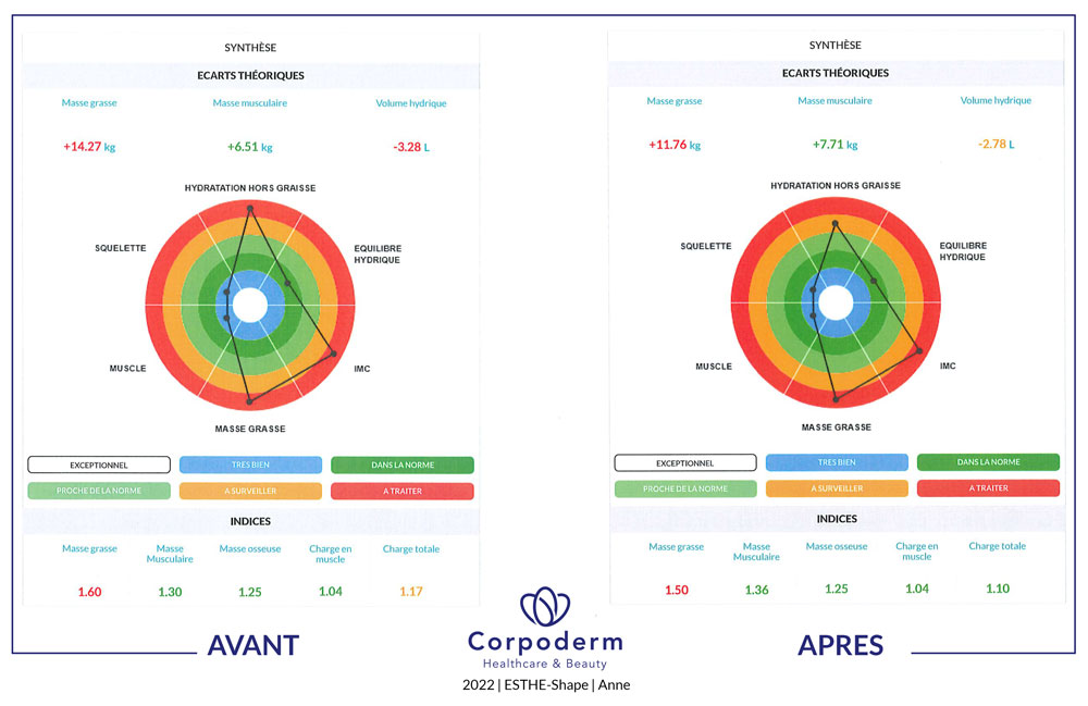 mesures impédancemétrie